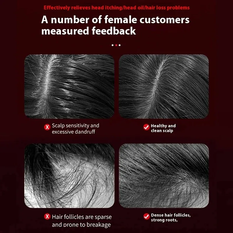 Electric Vibration Massage Com - Hair Care For Hair Loss ulasan dan harga