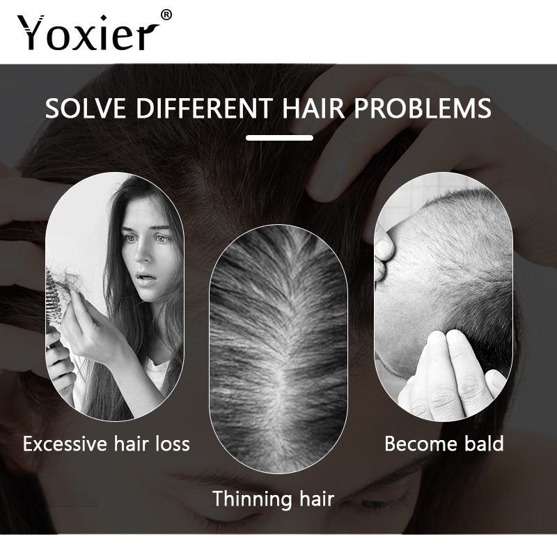 Intensive Growth Serum Prevent - Hair Care Treatment ulasan dan harga