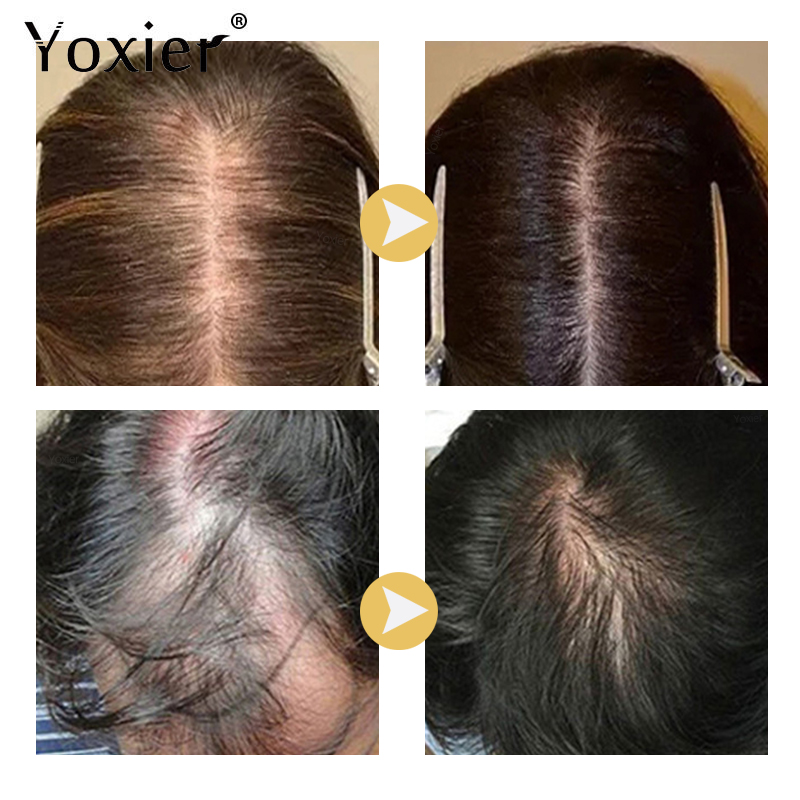 Intensive Growth Serum Prevent - Hair Care Treatment ulasan dan harga