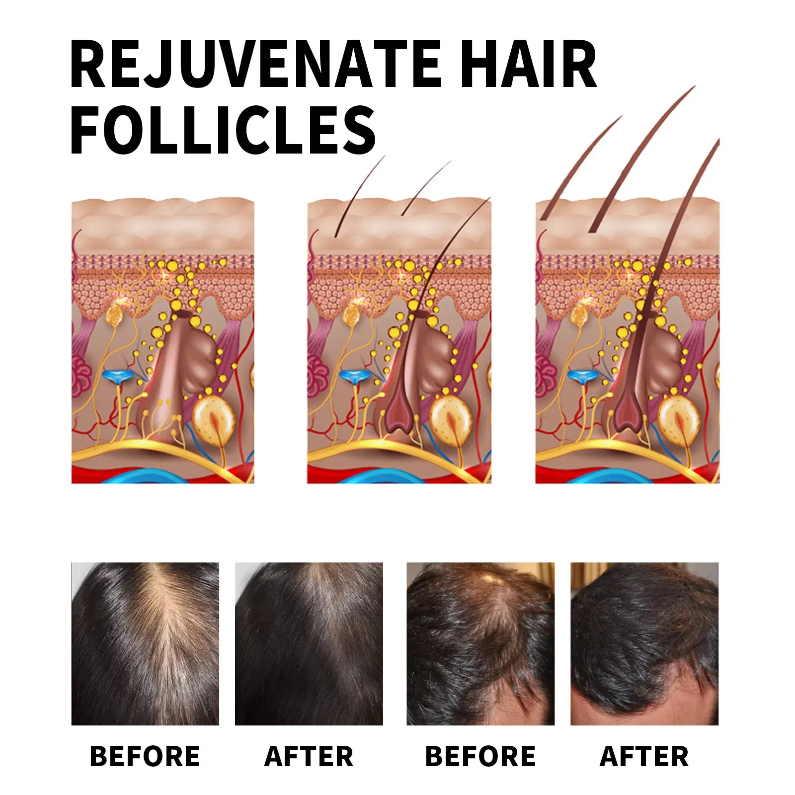 Ginger Hair Growth Products Fa - Hair Care For Dry And Frizzy Hair ulasan dan harga