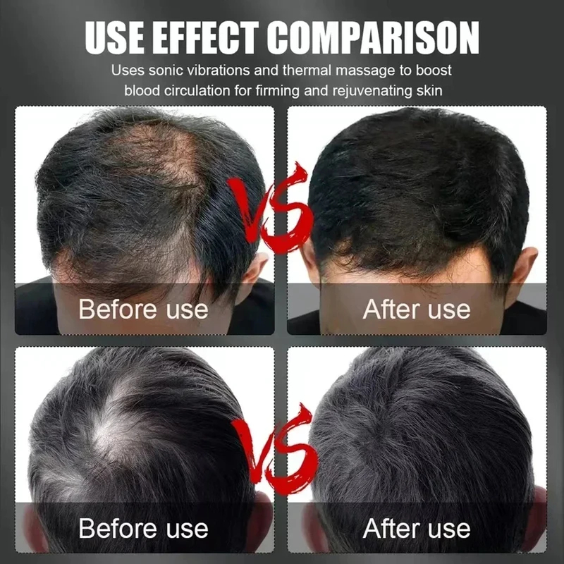 660nm 850nm Red Light Infrared - Hair Care For Hair Loss ulasan dan harga